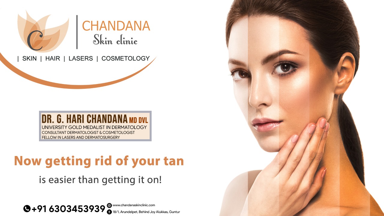 Tan Removal | Best Skin Clinic in Guntur | Chandana Skin Clinic