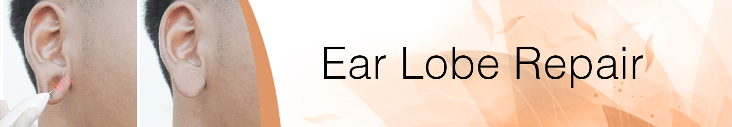 Best Clinic for Ear lope repair treatment in Guntur