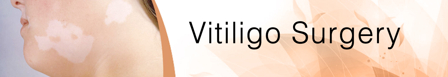 Best Skin Clinic for Vitiligo Surgery in Guntur
