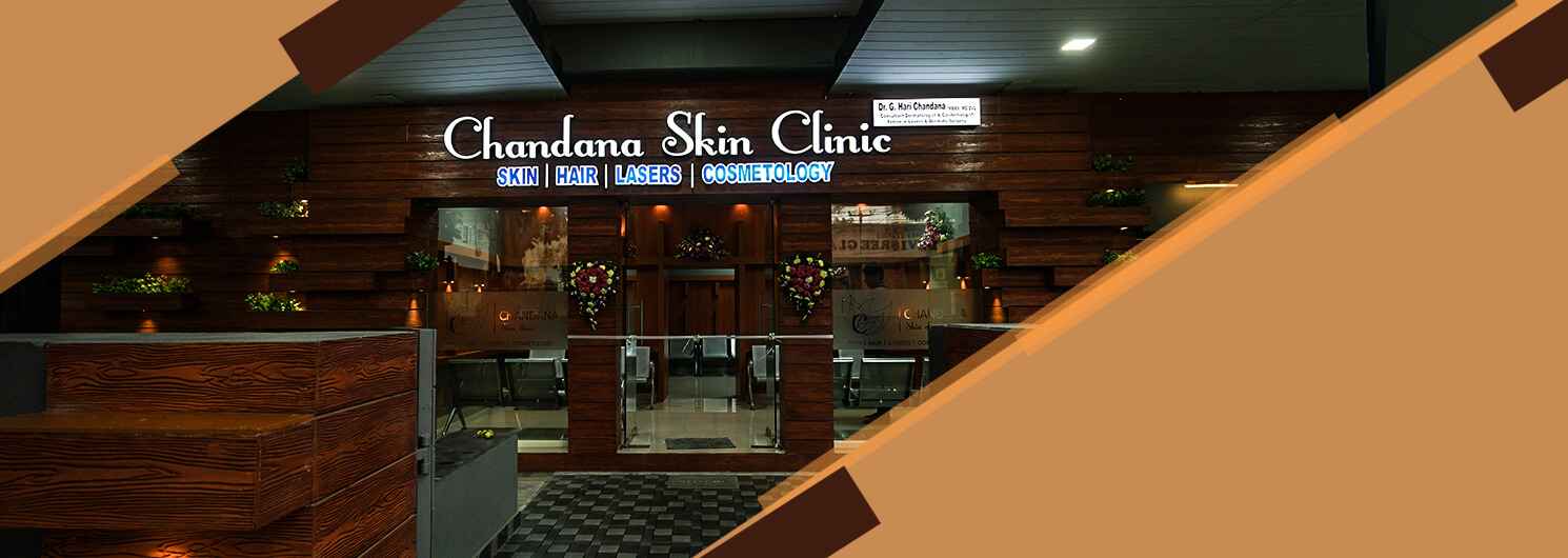 Best Skin Clinic in Guntur
